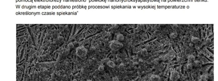 Ocena mikroskopowa warstw nano tlenkowych i powłok nanohydroksyapatytowych -1