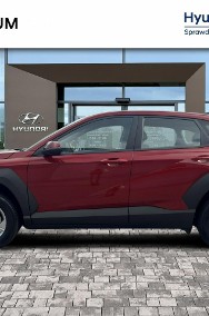 Hyundai Kona 1.6GDI 129KM Hybrid MY25 Smart+Comfort Android Auto Salon PL Gwar 20-2
