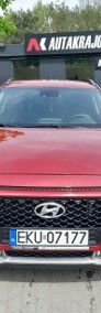 Hyundai Kona I (2017-2023)-3
