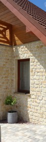 Domy elewacje kamień płytki na ściany z ciemnym dachem w stylu włoskim -4