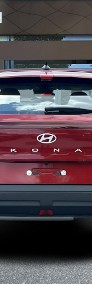 Hyundai Kona w wersji Smart+Comfort-4